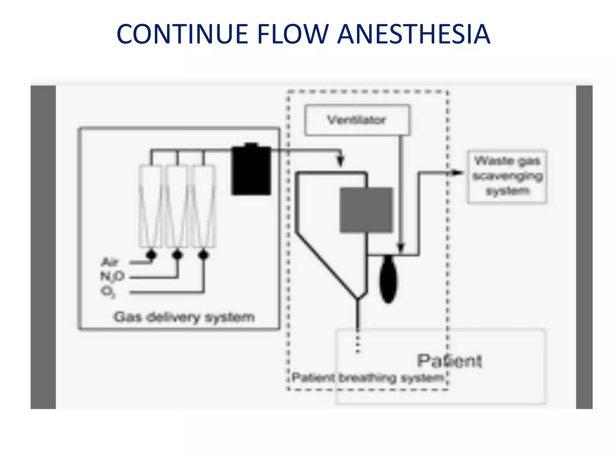 #Delivery of anesthetic agents | PPTX