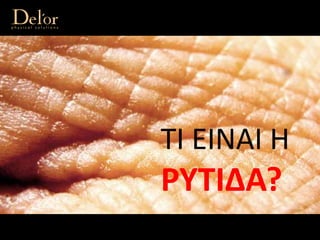 ΤΙ ΕΙΝΑΙ Η 
ΡΥΤΙΔΑ?
 