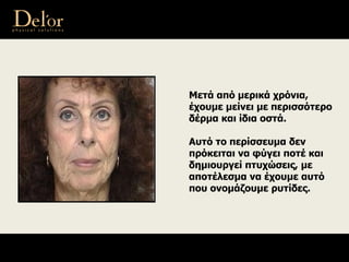 Μετά από μερικά χρόνια,
έχουμε μείνει με περισσότερο
δέρμα και ίδια οστά.
Αυτό το περίσσευμα δεν
πρόκειται να φύγει ποτέ και
δημιουργεί πτυχώσεις, με
αποτέλεσμα να έχουμε αυτό
που ονομάζουμε ρυτίδες.
 