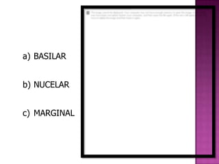 a) BASILAR


b) NUCELAR


c) MARGINAL
 