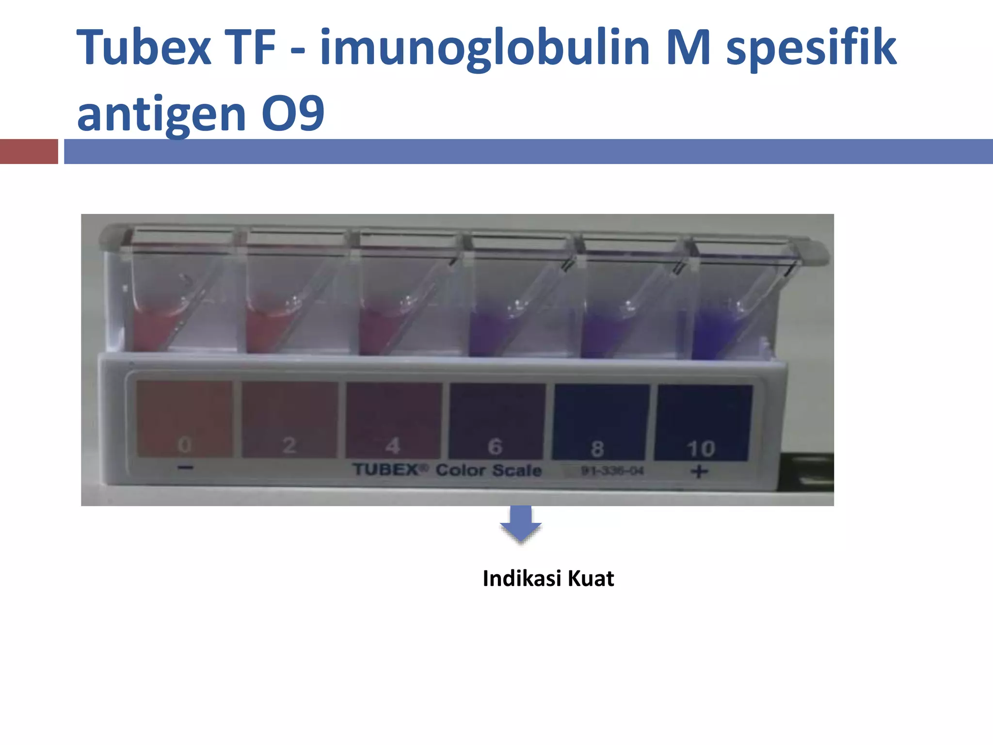 Tubex TF - imunoglobulin M spesifik
antigen O9
Indikasi Kuat
 
