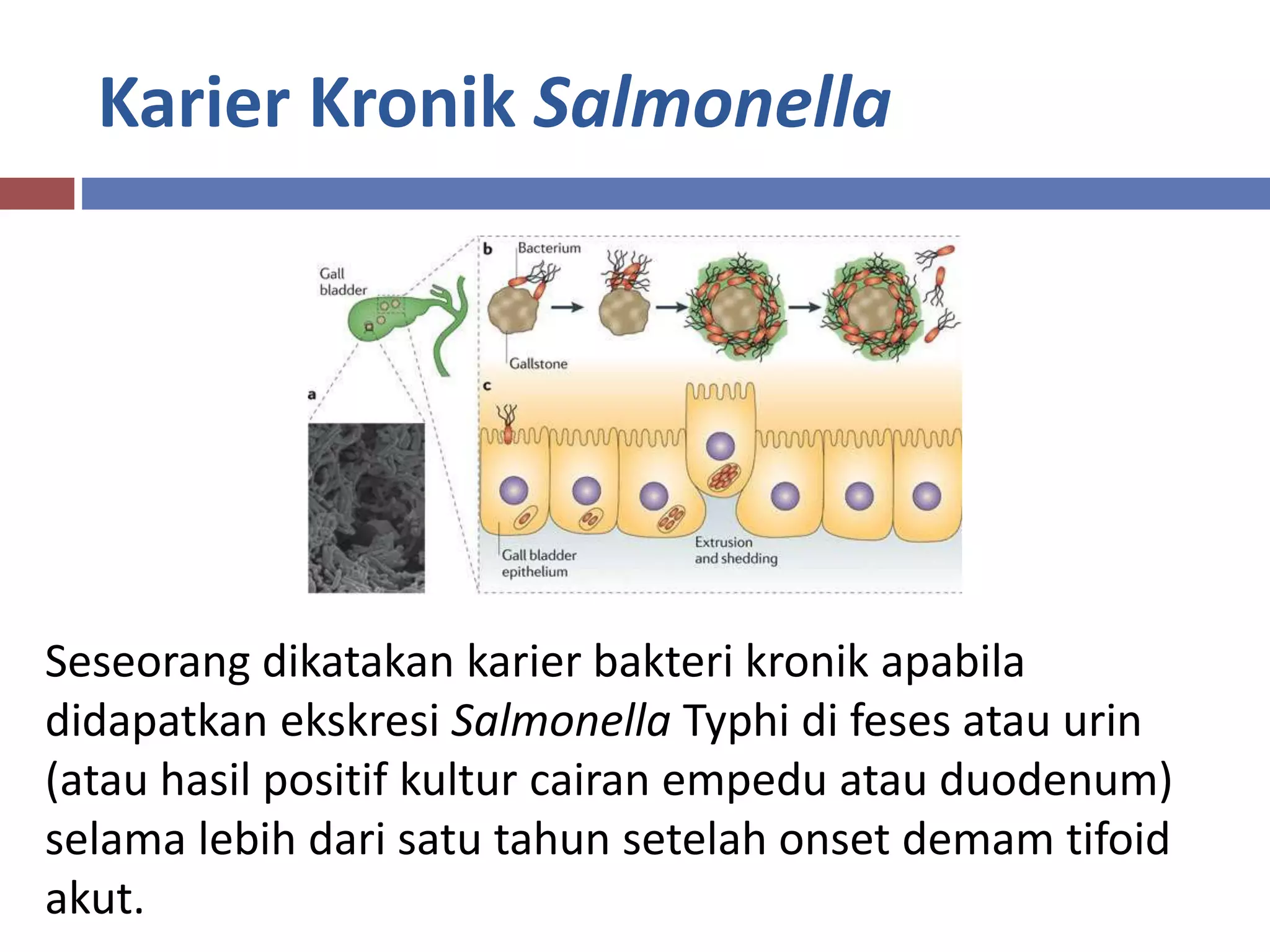 Karier Kronik Salmonella
Seseorang dikatakan karier bakteri kronik apabila
didapatkan ekskresi Salmonella Typhi di feses atau urin
(atau hasil positif kultur cairan empedu atau duodenum)
selama lebih dari satu tahun setelah onset demam tifoid
akut.
 