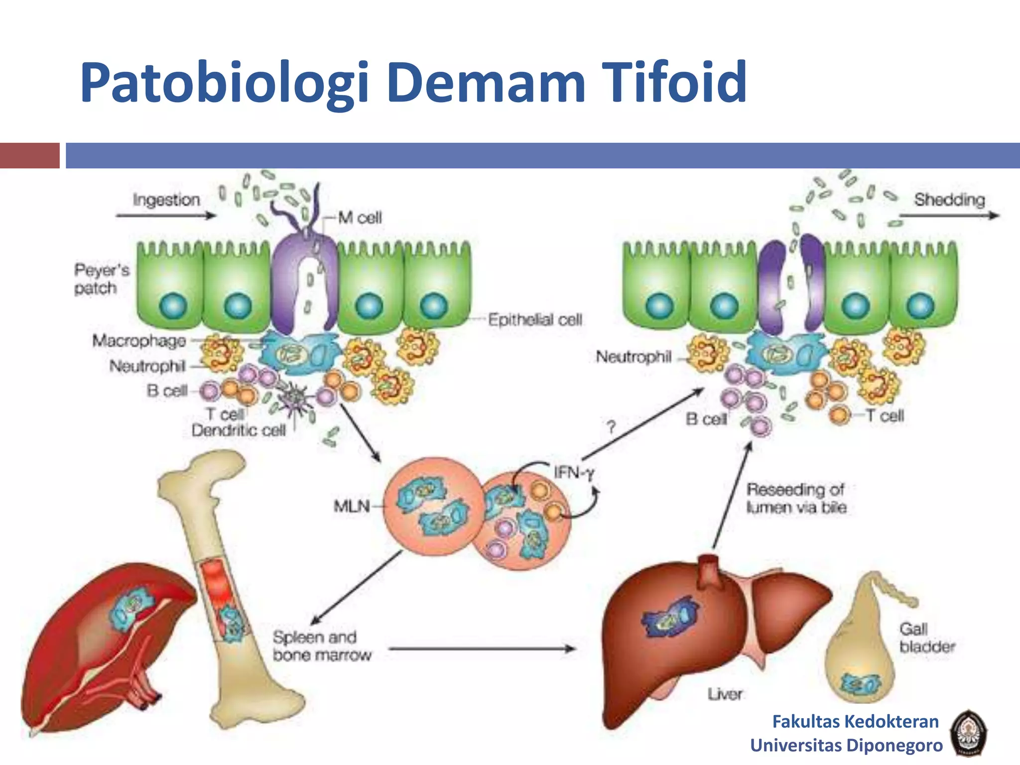 Patobiologi Demam Tifoid
Fakultas Kedokteran
Universitas Diponegoro
 