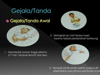 Gejala/Tanda  Gejala/TandaAwal2.  Seringkaliuluhatiterasanyeri,karenaterjadiperdarahanlambungMendadak panas tinggi selama 	2-7 hari, tampak lemah dan lesu3.  Tampak bintik-bintik merah pada kulit 	disebabkan pecahnya pembuluh kapiler