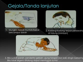 Gejala/Tanda lanjutanMungkin terjadi muntah/berak 	bercampur darah2. Kadang-kadang terjadi perdarahan     di hidung (mimisan)3. Bila sudah parah, penderita gelisah, ujung tangan dan kaki dingin berkeringat.     Bila tidak segera ditolong dapat meninggal dunia