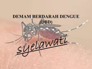DEMAM BERDARAH DENGUE
(DBD)
 
