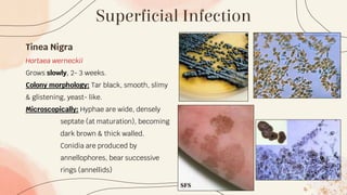 Superficial Infection
Tinea Nigra
Hortaea werneckii
Grows slowly, 2- 3 weeks.
Colony morphology: Tar black, smooth, slimy
& glistening, yeast- like.
Microscopically: Hyphae are wide, densely
septate (at maturation), becoming
dark brown & thick walled.
Conidia are produced by
annellophores, bear successive
rings (annellids)
 
