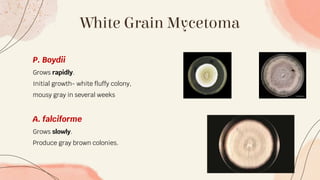 White Grain Mycetoma
P. Boydii
Grows rapidly.
Initial growth- white fluffy colony,
mousy gray in several weeks
A. falciforme
Grows slowly.
Produce gray brown colonies.
 