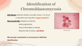 Identification of
Chromoblastomycosis
KOH Mount: Sclerotic bodies (rounded, brown, 4 to 10 μm
in diameter and resemble “copper pennies”).
Macroscopically: Heaped up colonies.
Darkly pigmented.
Gray to Olive Black & Velvety.
Reverse side of colony is jet black.
Microscopic examination is necessary for definitive
identification.
Sclerotic bodies
 
