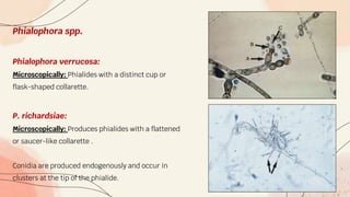 Phialophora spp.
Phialophora verrucosa:
Microscopically: Phialides with a distinct cup or
flask-shaped collarette.
P. richardsiae:
Microscopically: Produces phialides with a flattened
or saucer-like collarette .
Conidia are produced endogenously and occur in
clusters at the tip of the phialide.
 