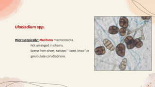 Ulocladium spp.
Microscopically: Muriform macroconidia.
Not arranged in chains.
Borne from short, twisted ‘‘ bent-knee’’ or
geniculate conidiophore.
 
