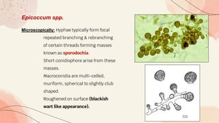 Epicoccum spp.
Microscopically: Hyphae typically form focal
repeated branching & rebranching
of certain threads forming masses
known as sporodochia.
Short conidiophore arise from these
masses.
Macroconidia are multi-celled,
muriform, spherical to slightly club
shaped.
Roughened on surface (blackish
wart like appearance).
 