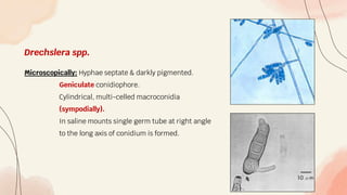 Drechslera spp.
Microscopically: Hyphae septate & darkly pigmented.
Geniculate conidiophore.
Cylindrical, multi-celled macroconidia
(sympodially).
In saline mounts single germ tube at right angle
to the long axis of conidium is formed.
 