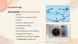 Curvularia spp.
Microscopically: Hyphae are dematiaceous &
septate.
Conidiophore are geniculate &
twisted.
Conidia are golden brown,
arranged sympodially,
multi-celled.
Central cells grow more rapidly &
are larger than those at
ends(lighter) resulting in Curved
or “boomerang’’ appearance.
 