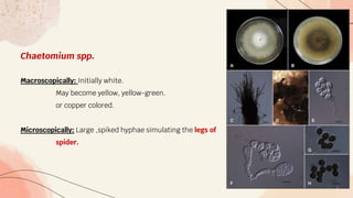 Chaetomium spp.
Macroscopically: Initially white.
May become yellow, yellow-green.
or copper colored.
Microscopically: Large ,spiked hyphae simulating the legs of
spider.
 