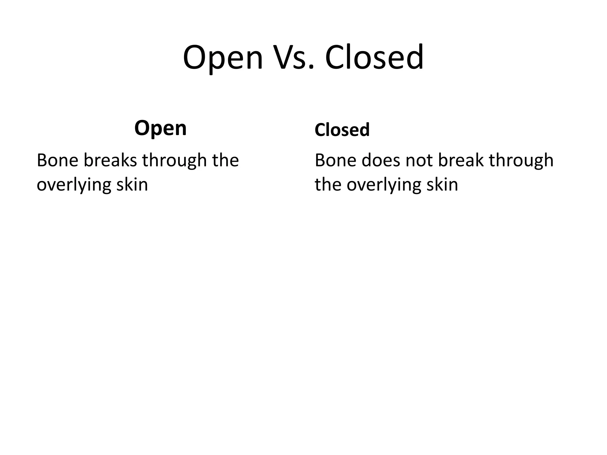 Open Vs. Closed
           Open           Closed
Bone breaks through the   Bone does not break through
overlying skin            the overlying skin
 