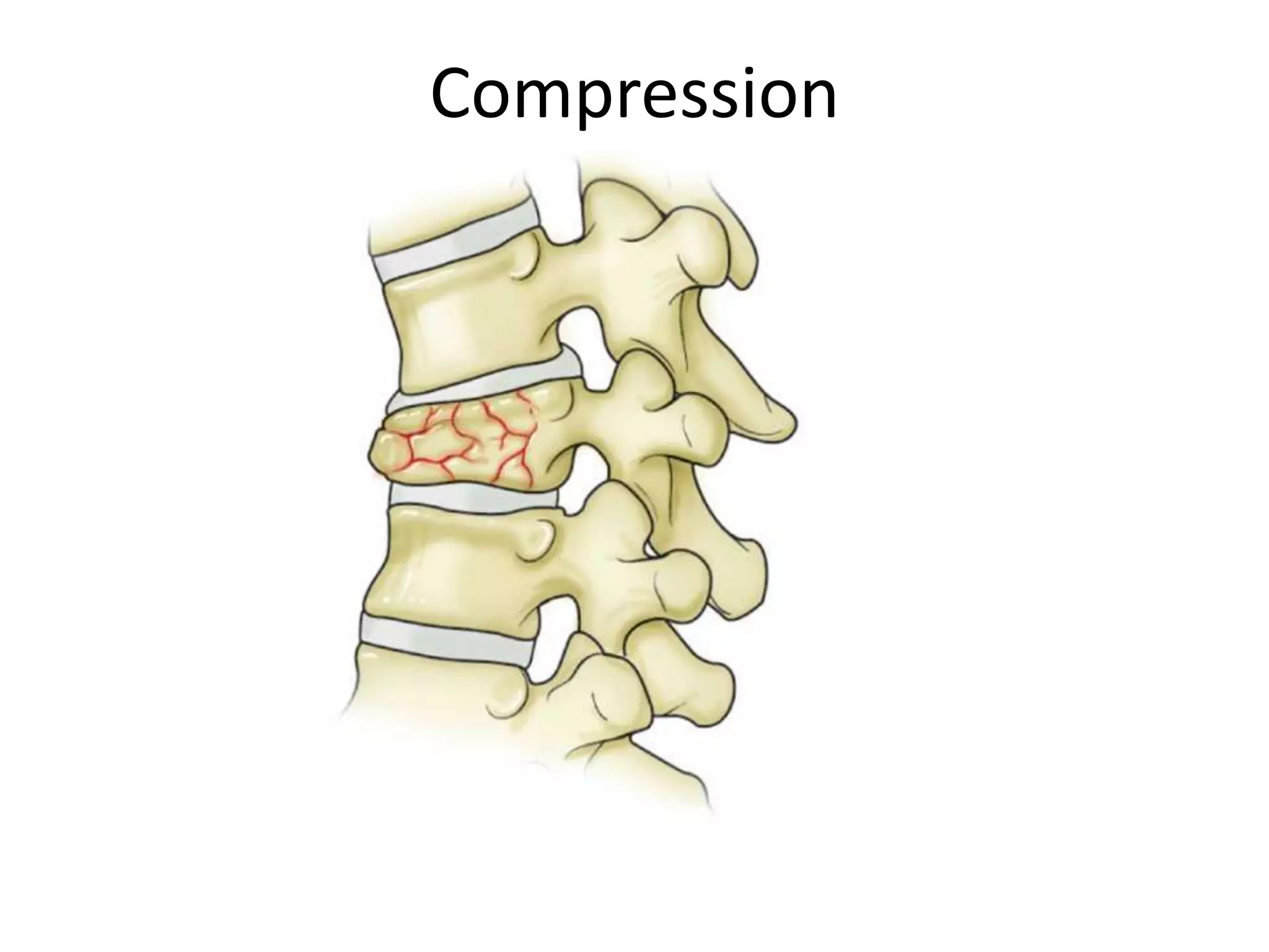 Compression
 