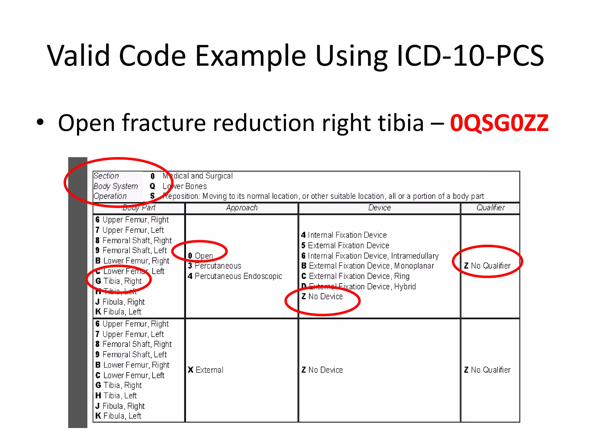 Valid Code Example Using ICD-10-PCS
• Open fracture reduction right tibia – 0QSG0ZZ
 