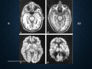 N AD
Jorge Ernesto de la Mata Flores
 