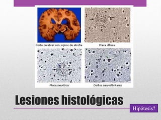 Lesiones histológicas Hipótesis?
 