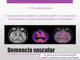 Demencia vascular
• 18% casos demencia
• Caracterizada por pérdida de la función cognitiva, a consecuencia
de un accidente vascular cerebral (isquémica o hemorrágica).
La relación entre la enfermedad vascular
cerebral y la demencia está poco caracterizada.
 
