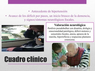 Cuadro clínico
• Antecedente de hipertensión
• Avance de los déficit por pasos, un inicio brusco de la demencia,
y signos/síntomas neurológicos focales.
Valoración neurológica
Parálisis pseudobulbar con disartria, disfagia y
emocionalidad patológica, déficit motores y
sensoriales focales, ataxia, apraxia de la
marcha, hiperreflexia y respuestas plantares
extensoras.
 