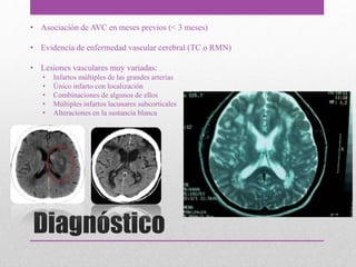 Diagnóstico
• Asociación de AVC en meses previos (< 3 meses)
• Evidencia de enfermedad vascular cerebral (TC o RMN)
• Lesiones vasculares muy variadas:
• Infartos múltiples de las grandes arterias
• Único infarto con localización
• Combinaciones de algunos de ellos
• Múltiples infartos lacunares subcorticales
• Alteraciones en la sustancia blanca
 
