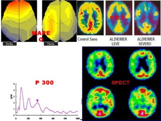 P.E.T. P.E.T. P 300 P 300 MAPEO 