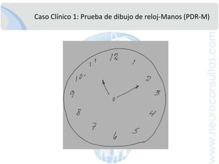 Severidad de EA en 37 casos: Cercado de LimaCustodio N, et al . AnFacMed 2008;69(4):233-238