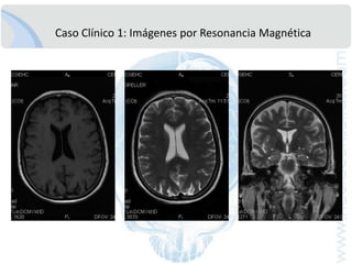 El “deteriorocognitivo” esdemencia?“Olvidos Frecuentes”PFAQ      PDR-M MMSEEvaluación Neuropsicológica MínimaENVEJECIMIENTODETERIORO COGNITIVO LEVE DEMENCIA