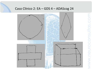 AgendaDiagnosticamosdemencia con mayor frecuencia?Caso 1: La embajadora “olvidadiza”Caso 2: La “conductaatípica” de la profesora
