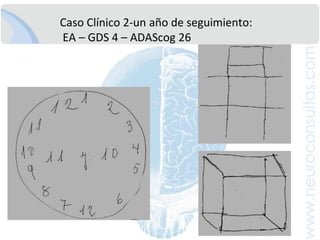 CasoClínico 2: AnamnesisMujer, 77 años de edad.4 gestaciones, un aborto. Madre de 3 hijos (F:2, M:1)Histerectomía a 45 años de edad: Fibroadenomas.Jubilada (60 años) profesoraeducaciónsecundaria.69 añosedad: Esposofallecidopor Ca Prostata. Catarata bilateral operada.70 añosedad: Osteoporosis.