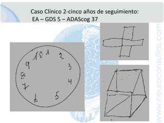 CasoClínico 2: AnamnesisPadre fallecido a los 90: InfartoMiocardio.Madre fallecida a los 93: Shock séptico. Ingresosreiterados a Emergencia-HMC porcuadros de agitaciónpsiquica. Deteriorocognitivoprogresivo.Hermanofallecido a los 35 poraccidenteautomovilístico.Hermana de 71 años con diagnostico de hipotiroidismo en tratamiento regular.Hermana de 74, aparentementesana.