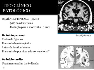 DEMÊNCIA TIPO ALZHEIMER
50% das demências
Evolução para a morte: 8 a 10 anos
De início precoce
Abaixo de 65 anos
Transmissão monogênica
Autossômica dominante
Transmissão por virus não convencional?
De início tardio
Usualmente acima da 8a década
22
Sexo F, 60 anos
 