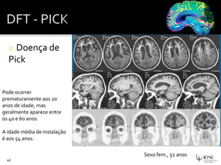o Doença de
Pick
45
Sexo fem., 52 anos
Pode ocorrer
prematuramente aos 20
anos de idade, mas
geralmente aparece entre
os 40 e 60 anos.
A idade média de instalação
é aos 54 anos.
 