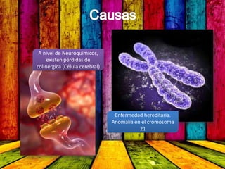 A nivel de Neuroquímicos,
existen pérdidas de
colinérgica (Célula cerebral)
Enfermedad hereditaria.
Anomalía en el cromosoma
21
 