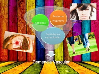 Demencia Vascular
Debilidad en
extremidades
Apoplejía
Trastorno
Progresivo
 