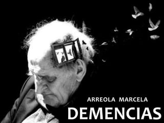 ARREOLA MARCELA 
DEMENCIAS 
 