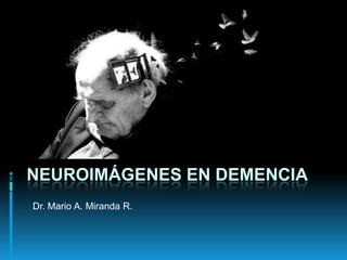 NEUROIMÁGENES EN DEMENCIA
Dr. Mario A. Miranda R.
 