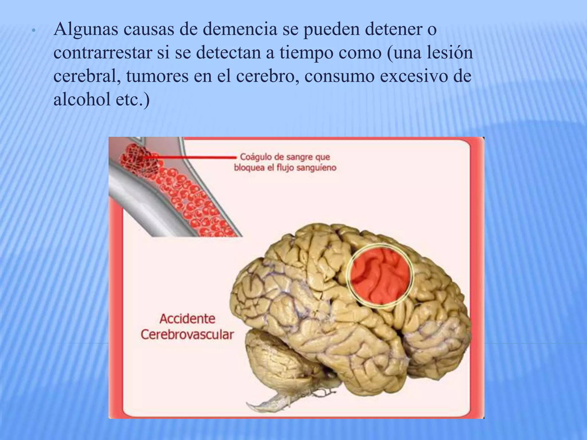 • Algunas causas de demencia se pueden detener o
contrarrestar si se detectan a tiempo como (una lesión
cerebral, tumores en el cerebro, consumo excesivo de
alcohol etc.)
 