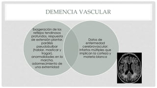 DEMENCIA VASCULAR 
Exageración de los 
reflejos tendinosos 
profundos, respuesta 
de extensión plantar, 
parálisis 
pseudobulbar 
(hablar, masticar y 
tragar), 
anormalidades en la 
marcha, 
adormecimiento de 
una extremidad 
Datos de 
enfermedad 
cerebrovascular: 
Infartos múltiples que 
implican la corteza y 
materia blanca 
 