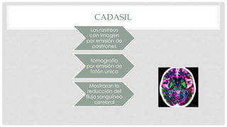 CADASIL 
Los rastreos 
con imagen 
por emisión de 
positrones 
tomografía 
por emisión de 
fotón único 
Mostraran la 
reducción del 
flujo sanguíneo 
cerebral 
 