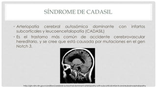 SÍNDROME DE CADASIL 
• Arteriopatía cerebral autosómica dominante con infartos 
subcorticales y leucoencefalopatía (CADASIL) 
• Es el trastorno más común de accidente cerebrovascular 
hereditario, y se cree que está causada por mutaciones en el gen 
Notch 3. 
http://ghr.nlm.nih.gov/condition/cerebral-autosomal-dominant-arteriopathy-with-subcortical-infarcts-and-leukoencephalopathy 
 
