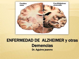 ENFERMEDAD DE ALZHEIMER y otras
         Demencias
          Dr. Aguirre jeanrro
 