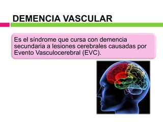 DEMENCIA VASCULAR
Es el síndrome que cursa con demencia
secundaria a lesiones cerebrales causadas por
Evento Vasculocerebral (EVC).
 