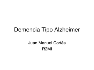 Demencia Tipo Alzheimer
Juan Manuel Cortés
R2MI
 