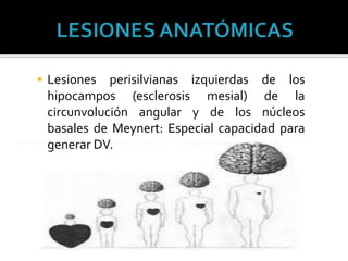  Lesiones perisilvianas izquierdas de los
hipocampos (esclerosis mesial) de la
circunvolución angular y de los núcleos
basales de Meynert: Especial capacidad para
generar DV.
 
