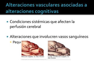  Condiciones sistémicas que afecten la
perfusión cerebral
 Alteraciones que involucren vasos sanguíneos
 Pequeño vaso arteriolas o vénulas
 