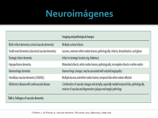 T O'Brien, J., & Thomas, A.; Vascular dementia. The Lancet, 2015: 386(10004), 1698-1706.
 