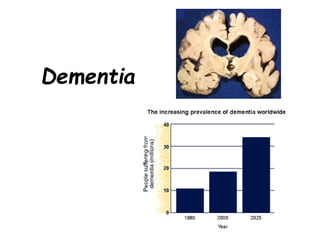 Dementia
 